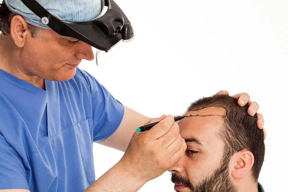 Haartransplantation Türkei – Volles Haar Und Urlaub Inklusive 6 Haarverpflanzung
