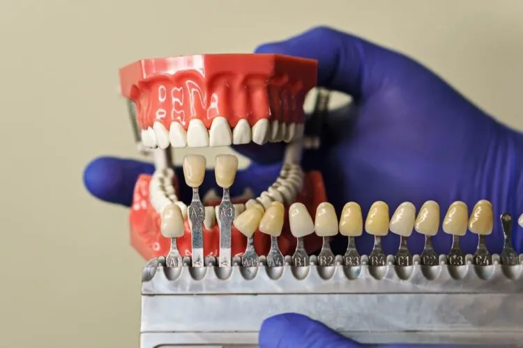 Hollywood Smile Türkei: Lächeln wie die Großen! 5 hollywood smile maltepe dental clinic istanbul tuerkei